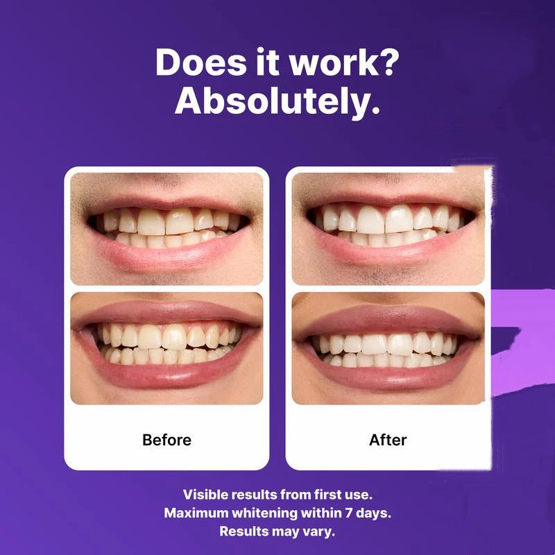 Bright Smile Co. PAP+ Purple Whitening Strips ? Advanced Kit